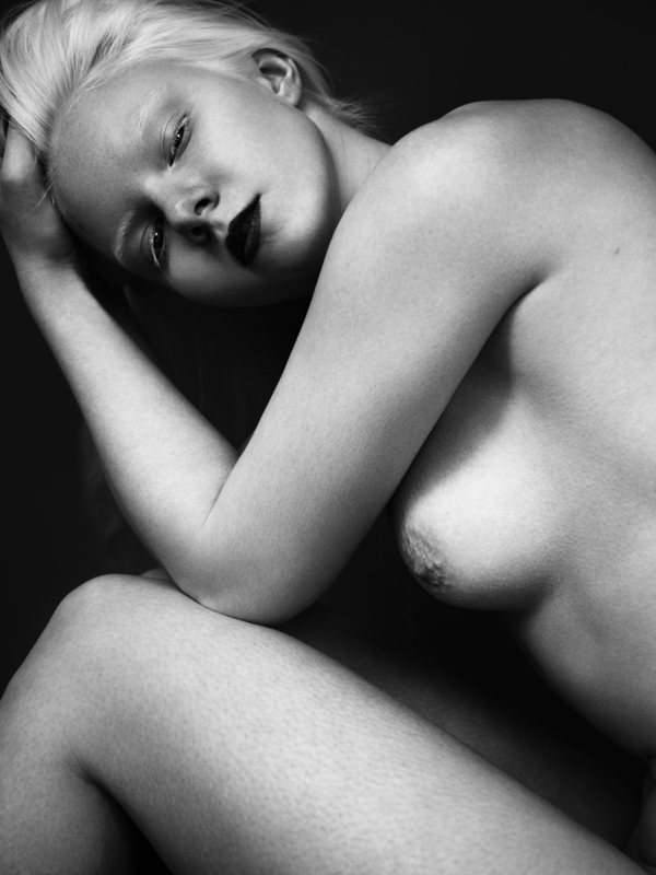 Albino Women Nude